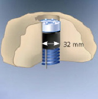 LED Beleuchtung